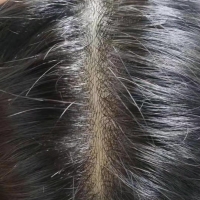 Protesi capelli umani base in finissimo velo frances(French lece) capelli umani europei attacco 4 settimane 